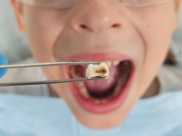 Best Emergency Pediatric Dentist  in South Chicago Heights, IL